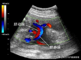 单脐动脉出现，孕妇们该注意什么？